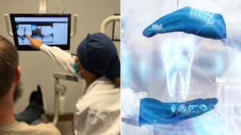 AI helps dentists catch more cavities and gum disease: It's 'unbiased' and gives 'more accurate' diagnoses