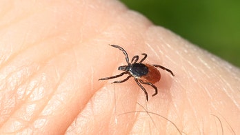 As Lyme disease tests miss many acute infections, potential at-home test offers hope for earlier diagnosis