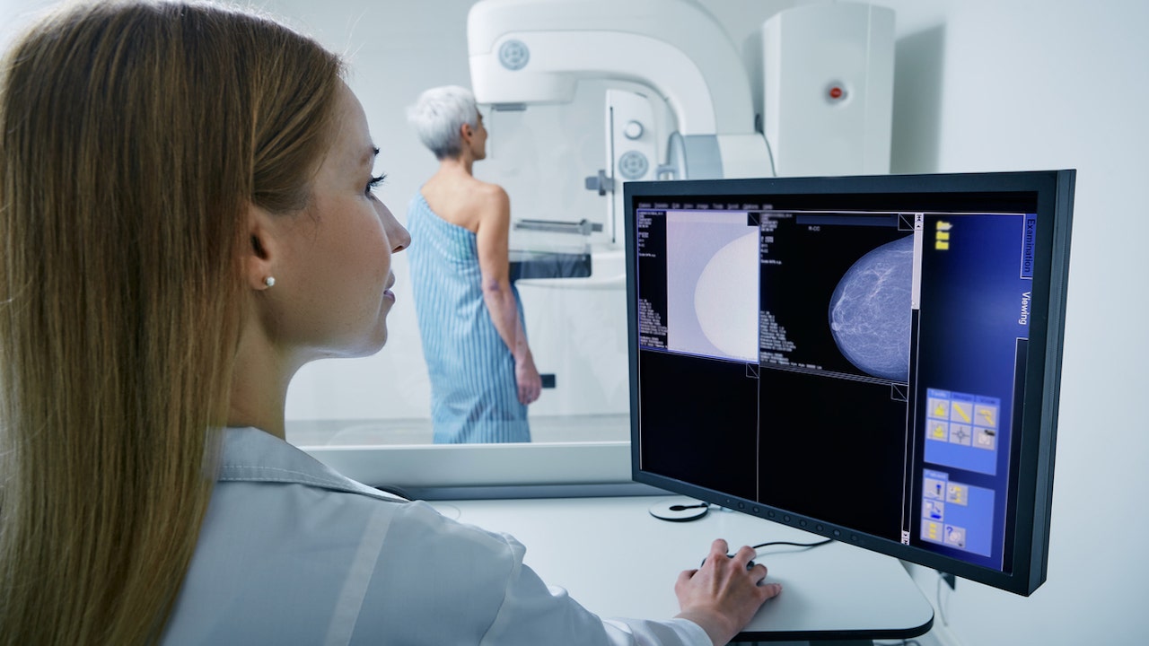 AI tech aims to detect breast cancer by mimicking radiologists’ eye movements: 'A critical friend'