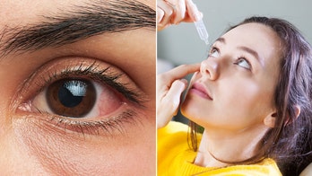 Be well: Treat and prevent pink eye with a health specialist's top tips